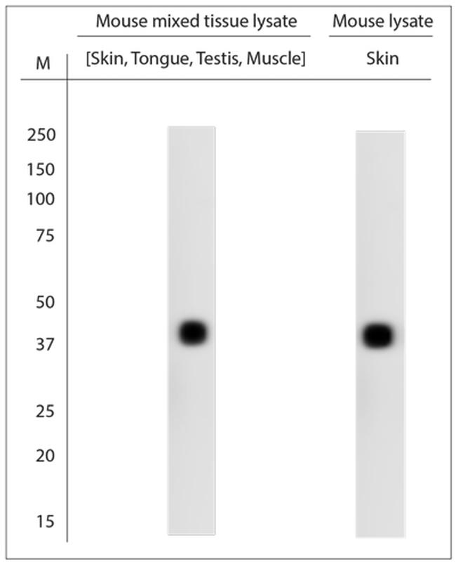 CXCR2 Antibody in Western Blot (WB)