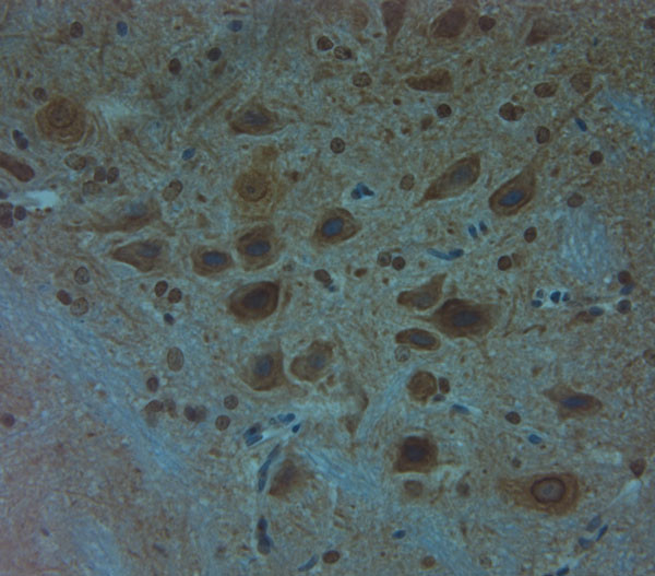 Clavesin 1 Antibody in Immunohistochemistry (Paraffin) (IHC (P))