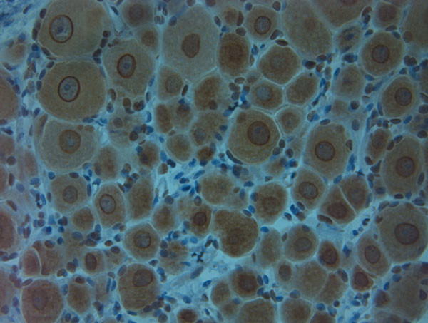 Clavesin 1 Antibody in Immunohistochemistry (Paraffin) (IHC (P))