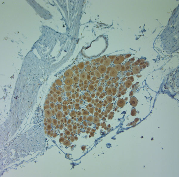 Clavesin 1 Antibody in Immunohistochemistry (Paraffin) (IHC (P))