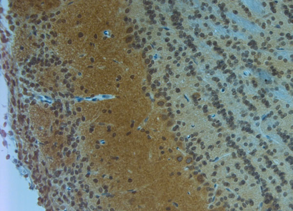 Clavesin 1 Antibody in Immunohistochemistry (Paraffin) (IHC (P))