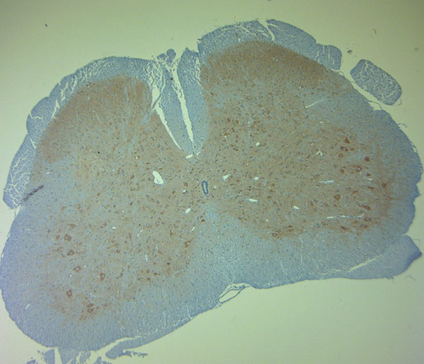 Clavesin 1 Antibody in Immunohistochemistry (Paraffin) (IHC (P))