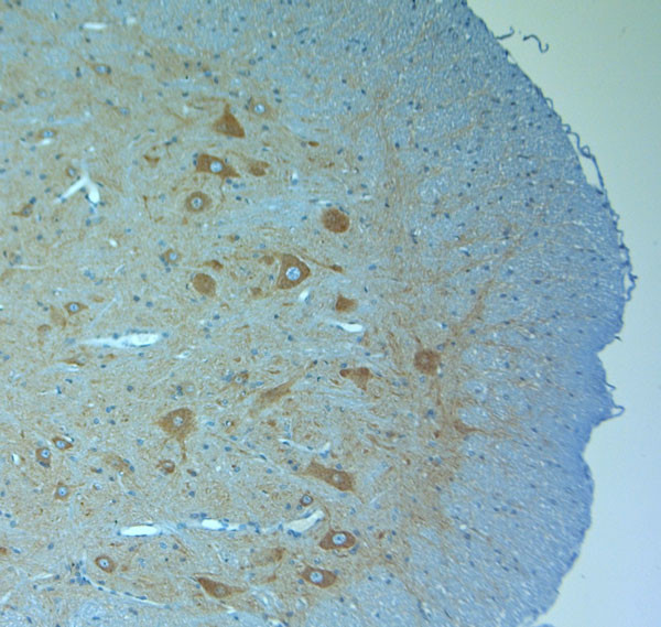 Clavesin 1 Antibody in Immunohistochemistry (Paraffin) (IHC (P))