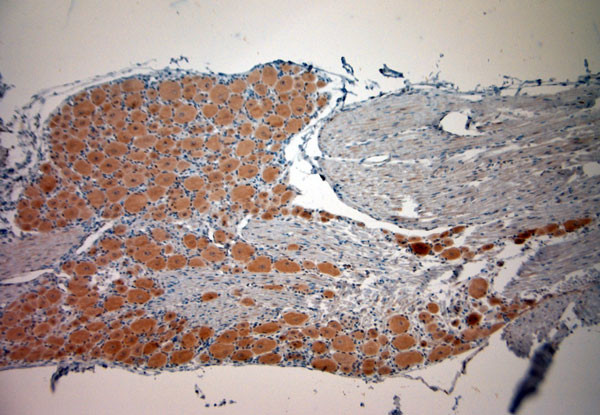 CACNA2D1 Antibody in Immunohistochemistry (Paraffin) (IHC (P))