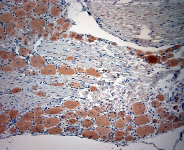 CACNA2D1 Antibody in Immunohistochemistry (Paraffin) (IHC (P))