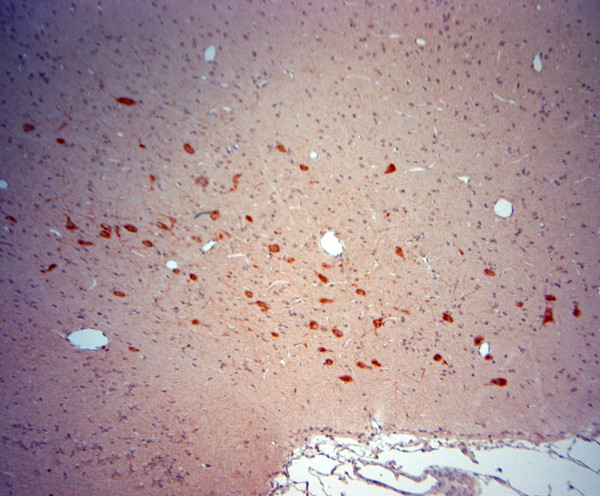 ChAT Antibody in Immunohistochemistry (Paraffin) (IHC (P))