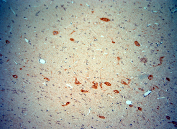 ChAT Antibody in Immunohistochemistry (Paraffin) (IHC (P))