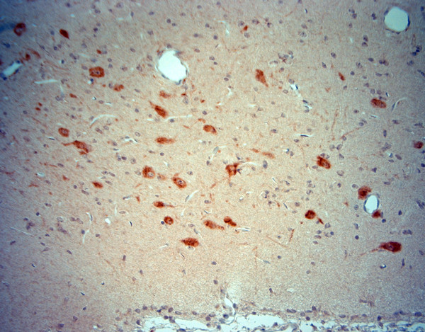 ChAT Antibody in Immunohistochemistry (Paraffin) (IHC (P))