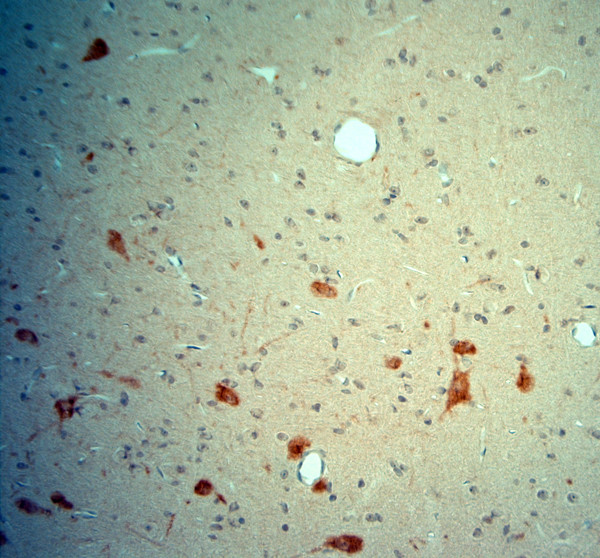 ChAT Antibody in Immunohistochemistry (Paraffin) (IHC (P))