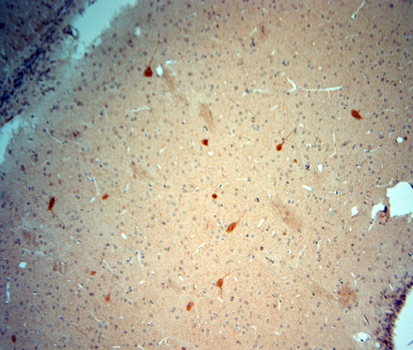 ChAT Antibody in Immunohistochemistry (Paraffin) (IHC (P))