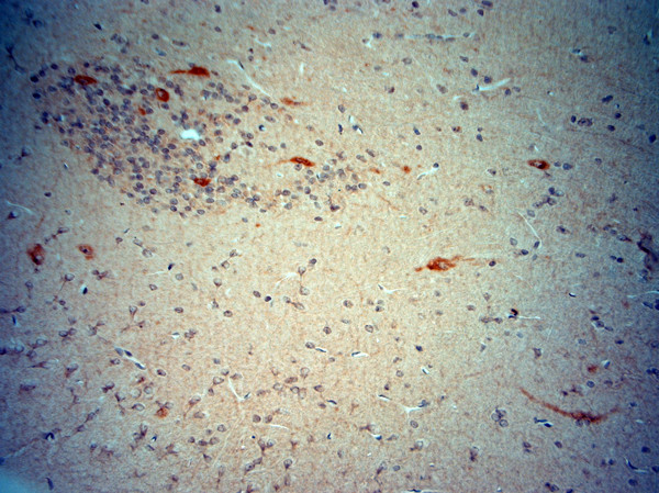 ChAT Antibody in Immunohistochemistry (Paraffin) (IHC (P))