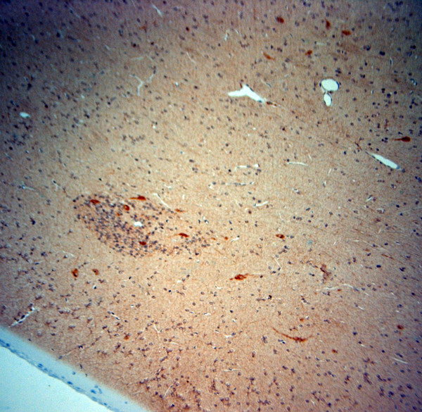 ChAT Antibody in Immunohistochemistry (Paraffin) (IHC (P))