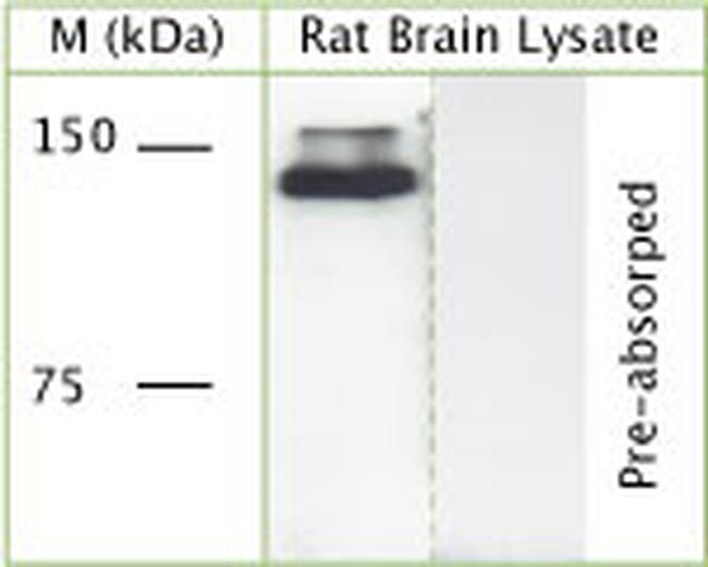 DCTN1 Antibody in Western Blot (WB)