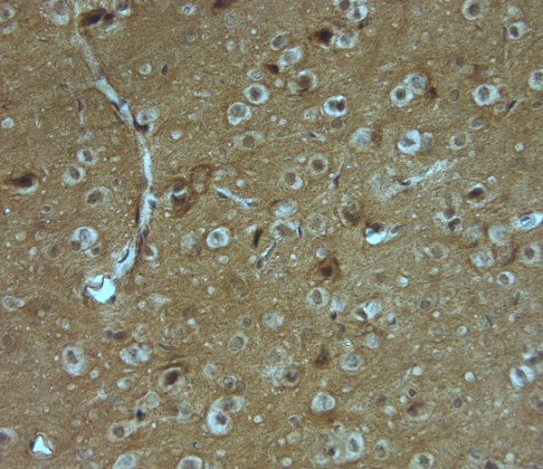 SAP97 Antibody in Immunohistochemistry (Paraffin) (IHC (P))