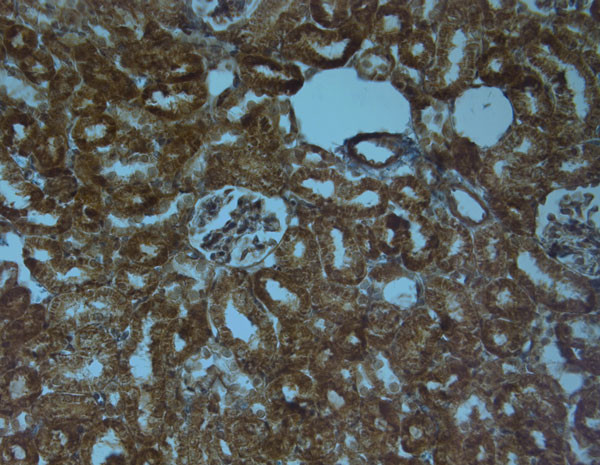 SAP97 Antibody in Immunohistochemistry (Paraffin) (IHC (P))