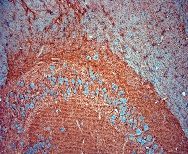 SLC1A2 Antibody in Immunohistochemistry (Paraffin) (IHC (P))