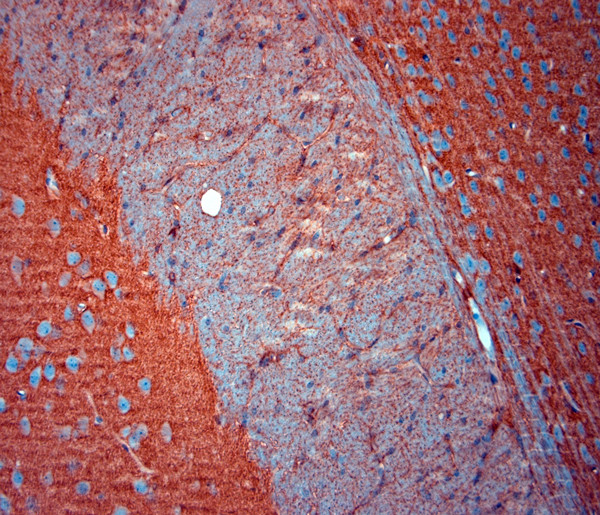 SLC1A2 Antibody in Immunohistochemistry (Paraffin) (IHC (P))