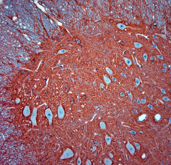 SLC1A2 Antibody in Immunohistochemistry (Paraffin) (IHC (P))