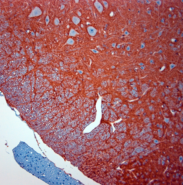 SLC1A2 Antibody in Immunohistochemistry (Paraffin) (IHC (P))