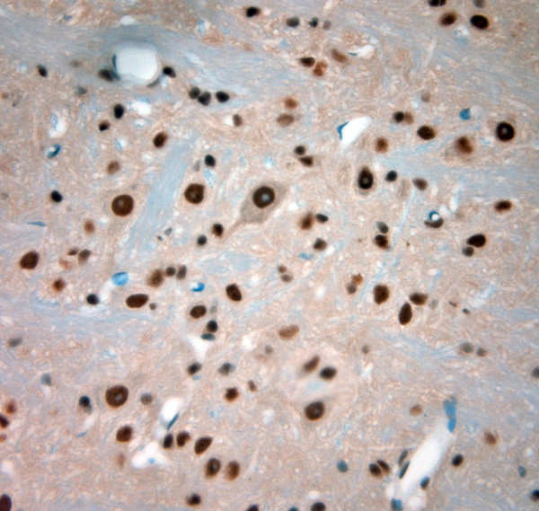 Bif-1 Antibody in Immunohistochemistry (Paraffin) (IHC (P))