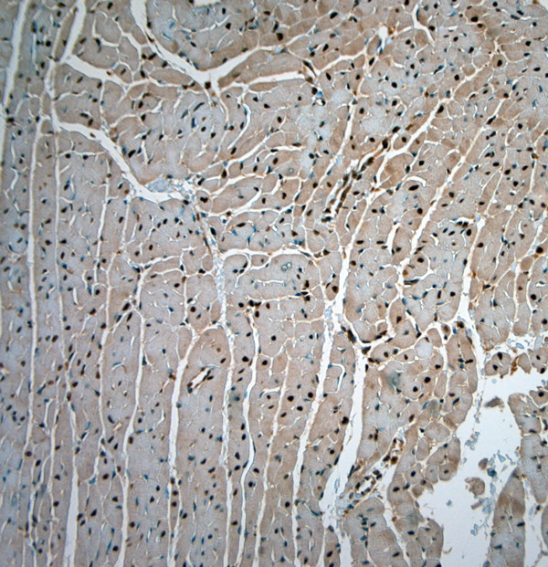 Bif-1 Antibody in Immunohistochemistry (Paraffin) (IHC (P))