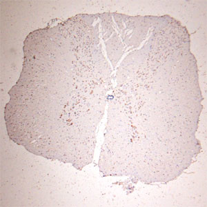 GLUR6 Antibody in Immunohistochemistry (Paraffin) (IHC (P))