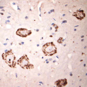 GLUR6 Antibody in Immunohistochemistry (Paraffin) (IHC (P))