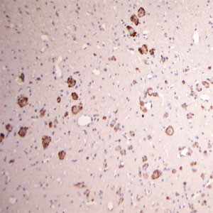 GLUR6 Antibody in Immunohistochemistry (Paraffin) (IHC (P))