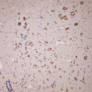 GLUR6 Antibody in Immunohistochemistry (Paraffin) (IHC (P))