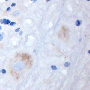 GRIK5 Antibody in Immunohistochemistry (Paraffin) (IHC (P))