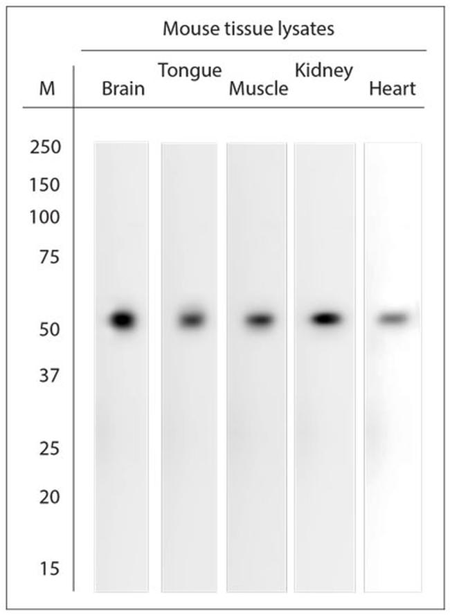 GABRA1 Antibody in Western Blot (WB)