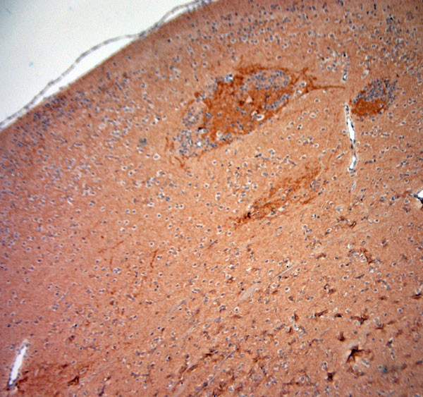 GAD65, 67 Antibody in Immunohistochemistry (Paraffin) (IHC (P))