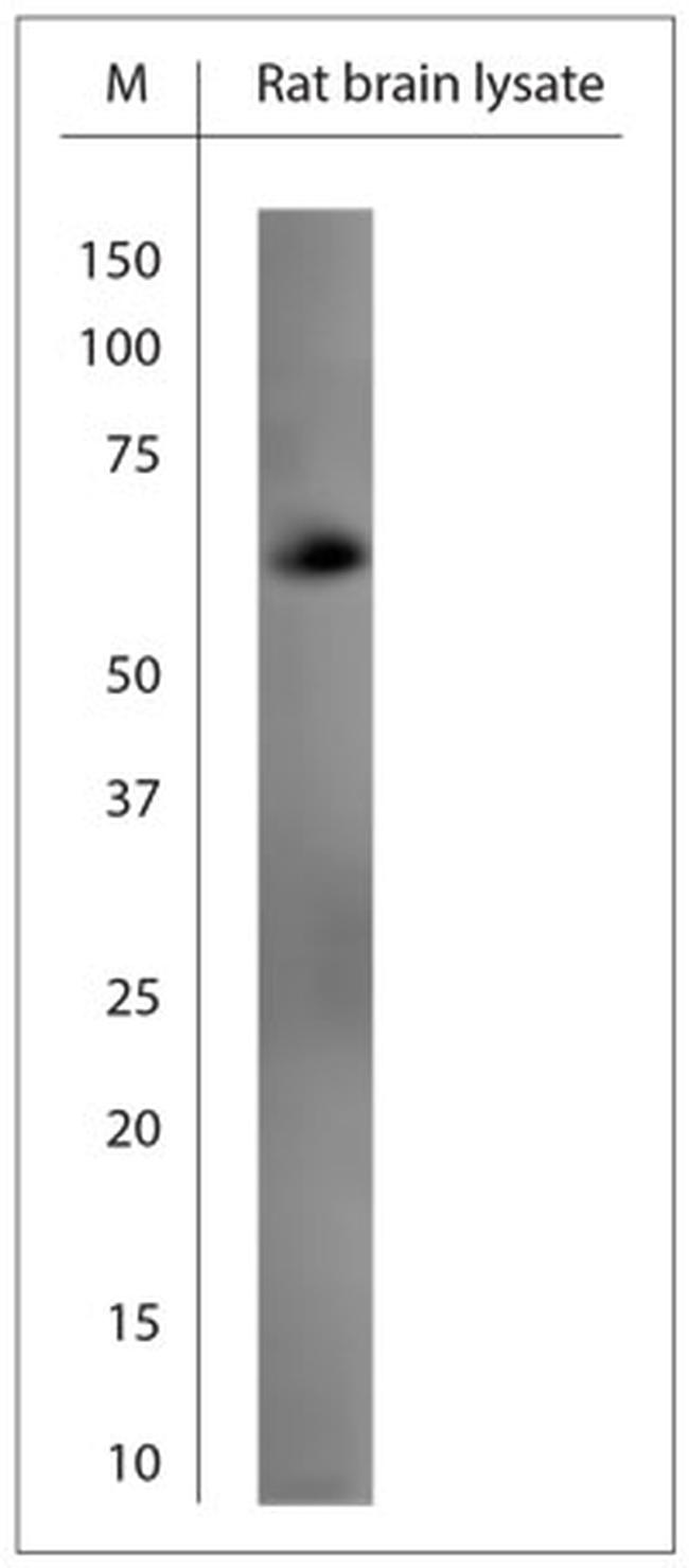 GAD65, 67 Antibody in Western Blot (WB)