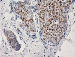 OSGEP Antibody in Immunohistochemistry (Paraffin) (IHC (P))