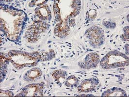 OSGEP Antibody in Immunohistochemistry (Paraffin) (IHC (P))