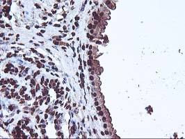 OSGEP Antibody in Immunohistochemistry (Paraffin) (IHC (P))