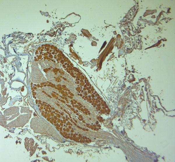 HOMER1 Antibody in Immunohistochemistry (Paraffin) (IHC (P))