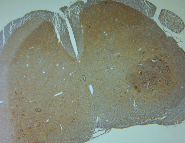 HOMER1 Antibody in Immunohistochemistry (Paraffin) (IHC (P))