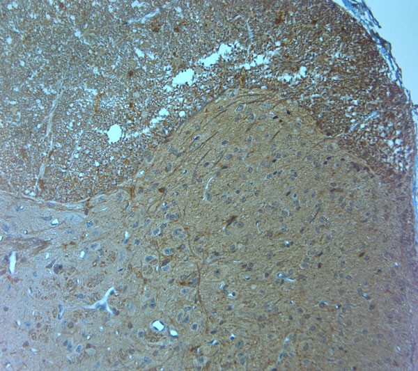 HOMER2 Antibody in Immunohistochemistry (Paraffin) (IHC (P))