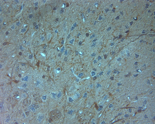 HOMER2 Antibody in Immunohistochemistry (Paraffin) (IHC (P))