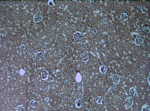 HIF1 alpha Antibody in Immunohistochemistry (Paraffin) (IHC (P))