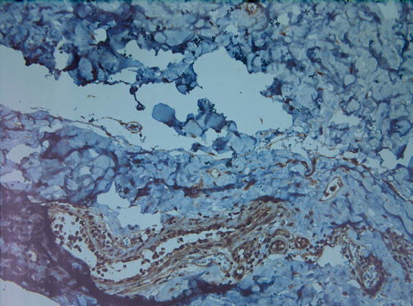 HIF1 alpha Antibody in Immunohistochemistry (Paraffin) (IHC (P))