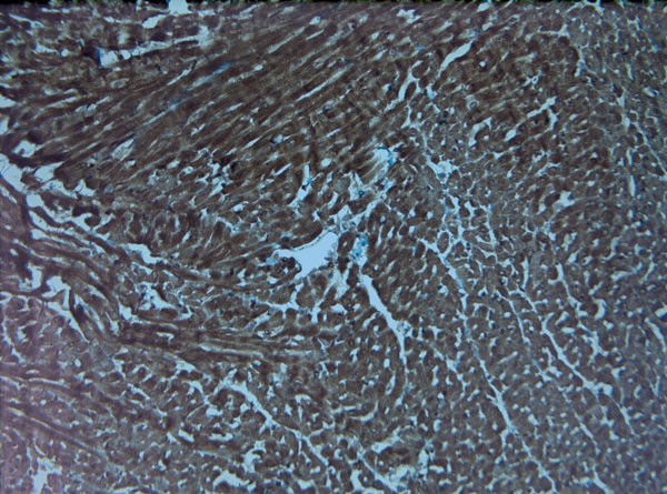 HIF1 alpha Antibody in Immunohistochemistry (Paraffin) (IHC (P))