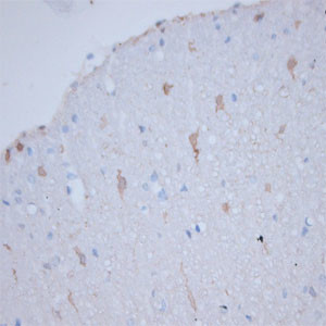 HPCA Antibody in Immunohistochemistry (Paraffin) (IHC (P))