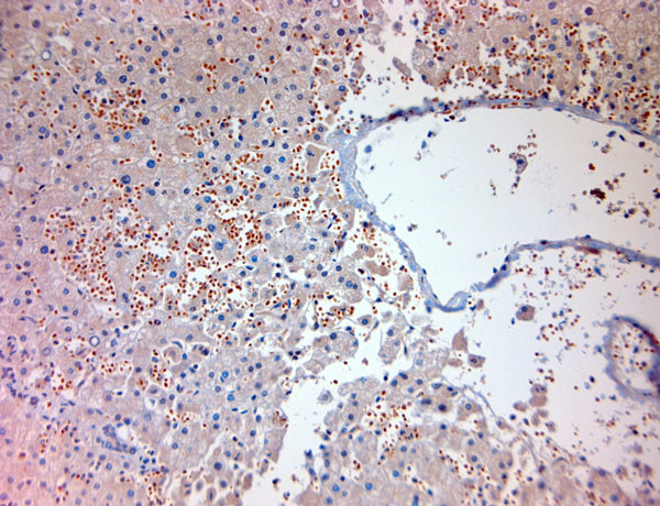 MPR 300 Antibody in Immunohistochemistry (Paraffin) (IHC (P))