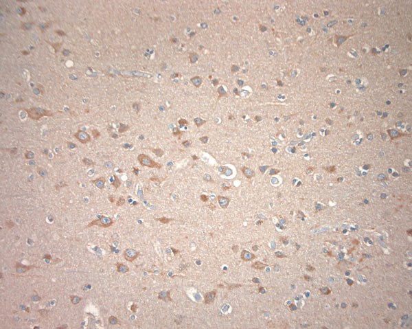 KCNA3 Antibody in Immunohistochemistry (Paraffin) (IHC (P))