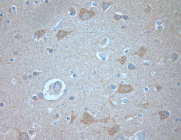 KCNA3 Antibody in Immunohistochemistry (Paraffin) (IHC (P))