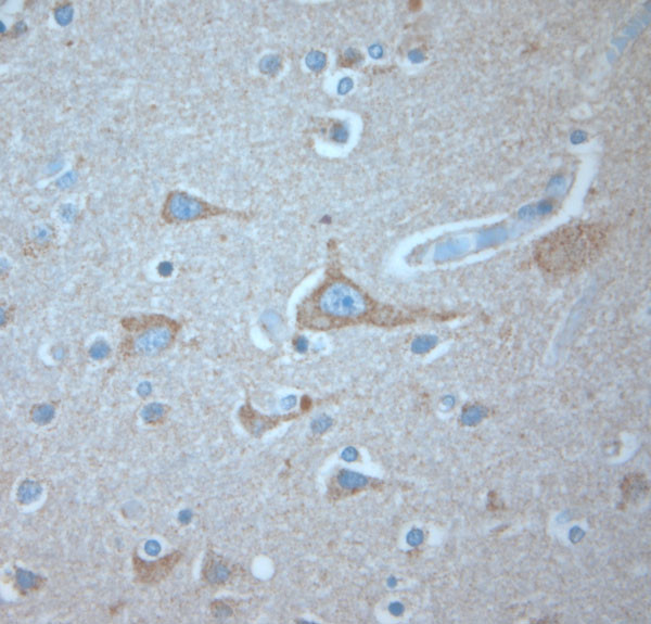 KCNA3 Antibody in Immunohistochemistry (Paraffin) (IHC (P))