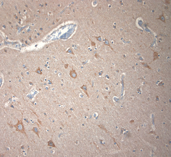 KCNA3 Antibody in Immunohistochemistry (Paraffin) (IHC (P))