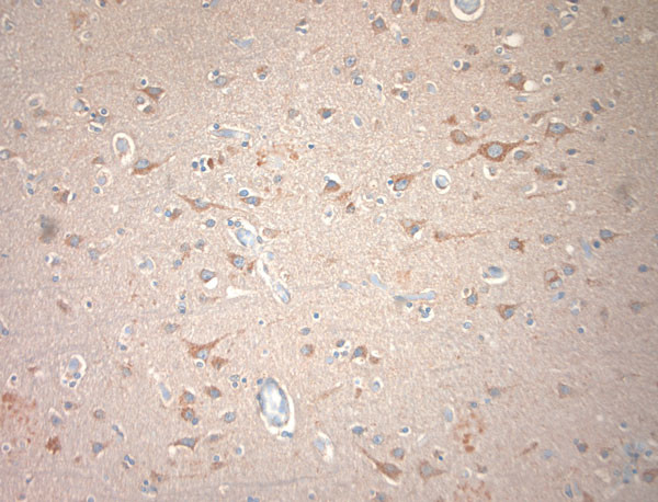 KCNA3 Antibody in Immunohistochemistry (Paraffin) (IHC (P))